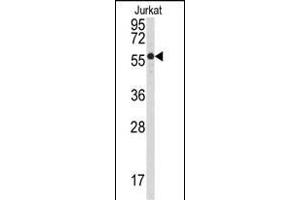 Western blot analysis of anti-P3CB Antibody (N-term) (ABIN392893 and ABIN2842292) in Jurkat cell line lysates (35 μg/lane).