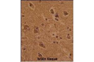 Formalin-fixed and paraffin-embedded human brain tissue with CTDP1 Antibody (N-term), which was peroxidase-conjugated to the secondary antibody, followed by DAB staining. (CTDP1 anticorps  (N-Term))