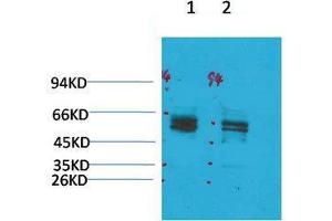 Western Blot (WB) analysis of 1) Rat Brain Tissue, 2)Mouse Brain Tissue with KV11. (KCNH2 anticorps)