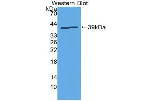 Western Blotting (WB) image for anti-Solute Carrier Family 6 (Neurotransmitter Transporter, Dopamine), Member 3 (SLC6A3) (AA 562-620) antibody (ABIN1867518)