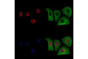 ABIN6256252 and ABIN6267454 staining Hela cells(4h of LPS treatment) by IF/ICC. (MKP1/2 (pSer296), (pSer318) anticorps)