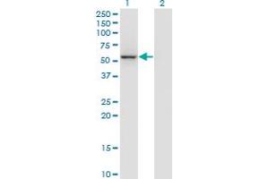 Western Blot analysis of GABPB2 expression in transfected 293T cell line by MGC29891 monoclonal antibody (M01), clone 3A3-1F4.