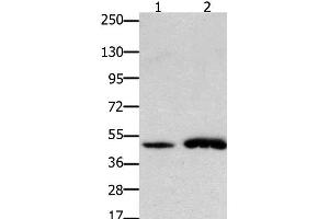 Western Blot analysis of Mouse brain and heart tissue using FOXL2 Polyclonal Antibody at dilution of 1:750 (FOXL2 anticorps)