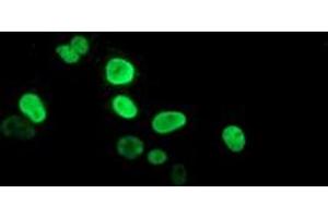 Anti-PPARA mouse monoclonal antibody (ABIN2455018) immunofluorescent staining of COS7 cells transiently transfected by pCMV6-ENTRY PPARA (RC216176). (PPARA anticorps  (AA 145-420))