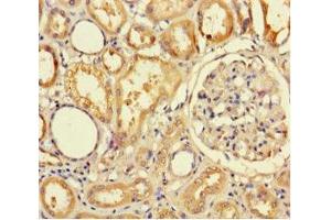 Immunohistochemistry of paraffin-embedded human kidney tissue using ABIN7173015 at dilution of 1:100 (TMPRSS7 anticorps  (Ser7))