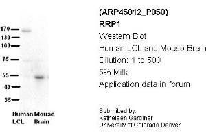 Image no. 2 for anti-Ribosomal RNA Processing 1 Homolog A (RRP1) (C-Term) antibody (ABIN2782369) (RRP1 anticorps  (C-Term))