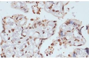 Immunohistochemistry of paraffin-embedded Human placenta using Phospho-CHEK1(S280) Polyclonal Antibody at dilution of 1:100 (40x lens). (CHEK1 anticorps  (pSer280))