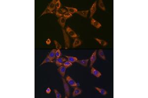 Immunofluorescence analysis of NIH-3T3 cells using Galectin 1/LG Rabbit mAb (ABIN7268197) at dilution of 1:100 (40x lens). (LGALS1/Galectin 1 anticorps)