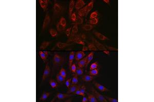 Immunofluorescence analysis of NIH/3T3 cells using TGF beta 1 antibody (ABIN7270909) at dilution of 1:150. (TGFB1 anticorps  (AA 30-278))