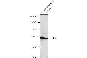 Western blot analysis of extracts of various cell lines using GLRA2 Polyclonal Antibody at dilution of 1:1000. (GLRa2 anticorps)