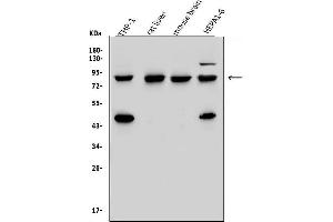 Western blot analysis of SORBS3 using anti-SORBS3 antibody (ABIN7603121).