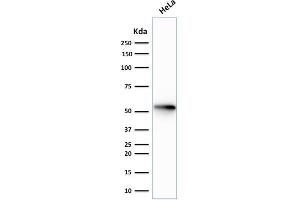 Western Blot Analysis of human HeLa cell lysate using CK7 Recombinant Mouse Monoclonal Antibody (rOV-TL12/30).