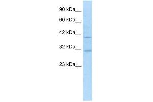 WB Suggested Anti-SIRT6 Antibody Titration:  1. (SIRT6 anticorps  (N-Term))