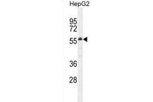 Western Blotting (WB) image for anti-alpha-2-HS-Glycoprotein (AHSG) antibody (ABIN2995522) (Fetuin A anticorps)