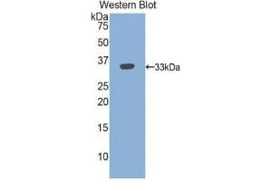 Western Blotting (WB) image for anti-Integrin beta 3 (ITGB3) (AA 135-377) antibody (FITC) (ABIN1174442)