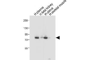 All lanes : Anti-LTF Antibody at 1:1000 dilution Lane 1: Human plasma tissue lysate Lane 2: Human fetal kidney tissue lysate Lane 3: Human uterus tissue lysate Lane 4: Human skeletal muscle tissue lysate Lysates/proteins at 20 μg per lane.