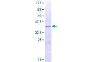 Image no. 1 for Transforming Growth Factor, beta 1 (TGFB1) (AA 279-390) protein (GST tag) (ABIN1322602)