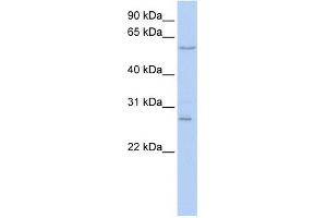 Neuropilin antibody used at 1 ug/ml to detect target protein. (Neuropilin 1 anticorps  (N-Term))