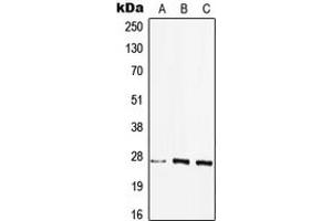 Western blot analysis of HLA-DQB2 expression in HEK293T (A), MCF7 (B), Raw264. (HLA-DQB2 anticorps  (Center))