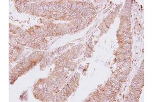 anti-threonyl-tRNA Synthetase (TARS) (AA 65-344) antibody