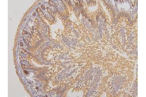 IHC analysis of RAB3GAP2 using anti-RAB3GAP2 antibody (ABIN6719633). (RAB3GAP2 anticorps  (AA 1-115))