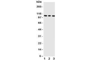 Western blot testing of ADAMTS1 antibody;  Lane 1: rat liver;  2: (r) heart;  3: (r) brain tissue lysate. (ADAMTS1 anticorps  (AA 956-968))