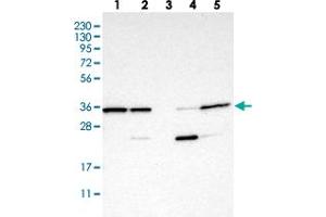 Western blot analysis of Lane 1: RT-4, Lane 2: U-251 MG, Lane 3: Human Plasma, Lane 4: Liver, Lane 5: Tonsil with C7orf20 polyclonal antibody . (Chromosome 7 Open Reading Frame 20 (C7orf20) anticorps)