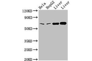 Western Blot Positive WB detected in: Hela whole cell lysate, HepG2 whole cell lysate, Rat liver tissue, Mouse liver tissue All lanes: CLINT1 antibody at 2 μg/mL Secondary Goat polyclonal to rabbit IgG at 1/50000 dilution Predicted band size: 69, 71 kDa Observed band size: 69 kDa