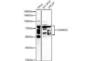 Western blot analysis of extracts of various cell lines, using C antibody (ABIN6130036, ABIN6137894, ABIN6137895 and ABIN6225248) at 1:500 dilution. (CAMKK2 anticorps  (AA 1-140))