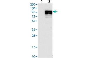 Western blot analysis of Lane 1: Negative control (vector only transfected HEK293T lysate), Lane 2: Over-expression Lysate (Co-expressed with a C-terminal myc-DDK tag (~3. (CCDC82 anticorps)