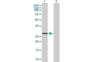 Western Blot analysis of VAPB expression in transfected 293T cell line by VAPB MaxPab polyclonal antibody. (VAPB anticorps  (AA 1-243))