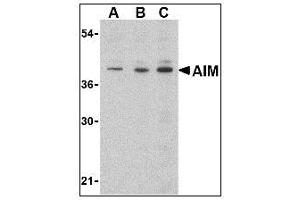 Image no. 1 for anti-CD5 Molecule-Like (CD5L) (C-Term) antibody (ABIN200118) (CD5L anticorps  (C-Term))