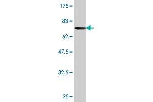 Western Blot detection against Immunogen (72.