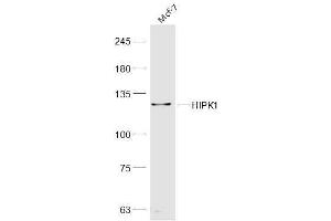 MCF-7 lysates probed with HIPK1 Polyclonal Antibody, Unconjugated  at 1:300 dilution and 4˚C overnight incubation. (HIPK1 anticorps  (AA 1-100))