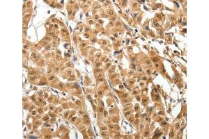 Immunohistochemistry (IHC) image for anti-Microtubule-Associated Protein 1A (MAP1A) antibody (ABIN2426949) (MAP1A anticorps)
