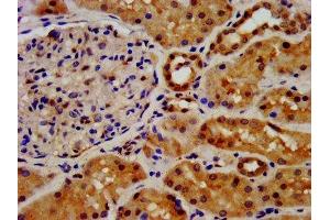 IHC image of ABIN7152853 diluted at 1:500 and staining in paraffin-embedded human kidney tissue performed on a Leica BondTM system.