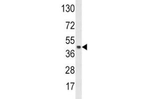 Western blot analysis of SKP2 antibody and HeLa lysate.