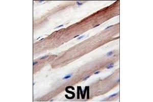 Formalin-fixed and paraffin-embedded human skeletal muscle reacted with Autophagy G4B Antibody  1809d , which was peroxidase-conjugated to the secondary antibody, followed by DAB staining. (ATG4B anticorps  (AA 258-284))
