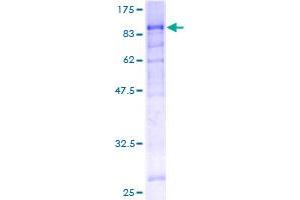Image no. 1 for Splicing Factor 1 (SF1) (AA 1-548) protein (GST tag) (ABIN1319699)