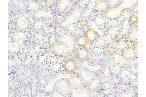 anti-CD3e Molecule, epsilon Associated Protein (CD3EAP) (C-Term) antibody