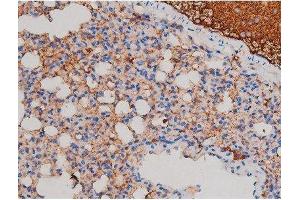 ABIN6267471 at 1/200 staining Mouse lung tissue sections by IHC-P.