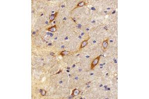 Immunohistochemical analysis of paraffin-embedded R. (CNR2 anticorps  (C-Term))