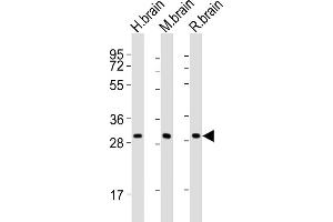 All lanes : Anti-KCNMB2 Antibody (C-term) at 1:2000 dilution Lane 1: human brain lysates Lane 2: mouse brain lysates Lane 3: rat brain lysates Lysates/proteins at 20 μg per lane.