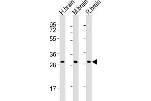 All lanes : Anti-KCNMB2 Antibody (C-term) at 1:2000 dilution Lane 1: human brain lysates Lane 2: mouse brain lysates Lane 3: rat brain lysates Lysates/proteins at 20 μg per lane. (KCNMB2 anticorps  (C-Term))