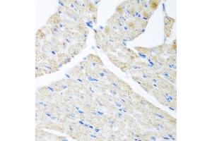 Immunohistochemistry of paraffin-embedded mouse heart using G antibody (ABIN6129967, ABIN6140880, ABIN6140881 and ABIN6223736) at dilution of 1:200 (40x lens). (GABARAPL2 anticorps  (AA 1-117))