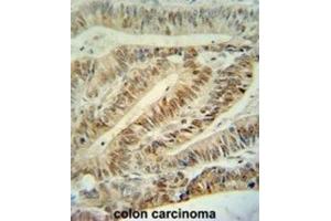 Immunohistochemistry (IHC) image for anti-Cullin 5 (CUL5) antibody (ABIN3003301)