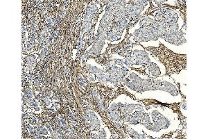 IHC analysis of F2R using anti-F2R antibody (ABIN7599952). (PAR1 anticorps  (AA 130-425))