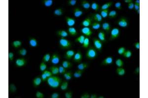 Immunofluorescence staining of Hela cells with ABIN7165653 at 1:100, counter-stained with DAPI.