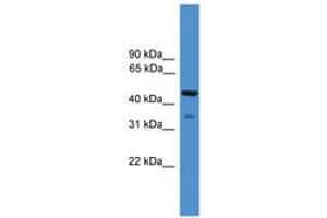 Image no. 1 for anti-TAF5-Like RNA Polymerase II, P300/CBP-Associated Factor (PCAF)-Associated Factor, 65kDa (TAF5L) (AA 100-149) antibody (ABIN6745408)
