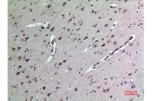 Immunohistochemistry (IHC) analysis of paraffin-embedded Human Brain, antibody was diluted at 1:100. (Midkine anticorps  (Internal Region))
